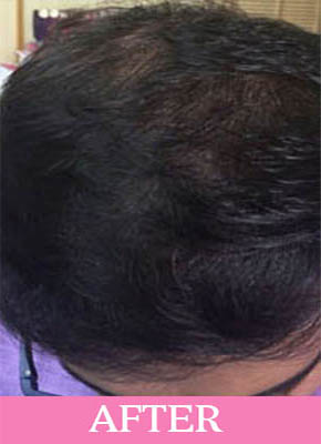 After-beforeafter