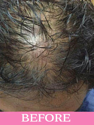 Before-Hair Treatment 
