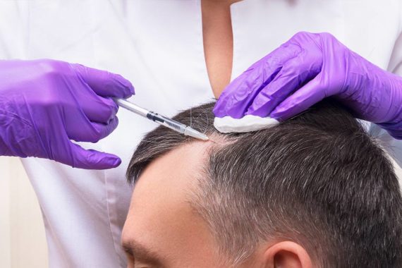 PRP Therapy in Indore